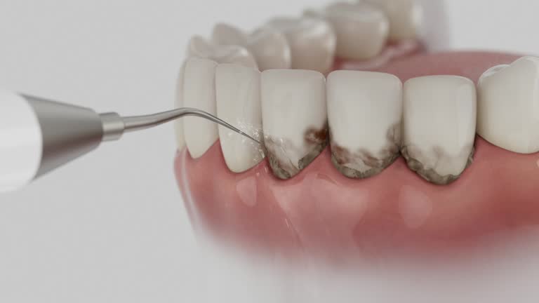 Reliable Teeth Cleaning And Checkup contractor in Richmond County County, GA by Dentist Open Now
